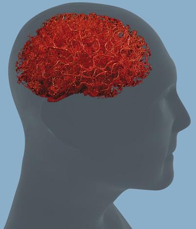 Arterien Blutgefäß Support (podpora cievneho systému) 